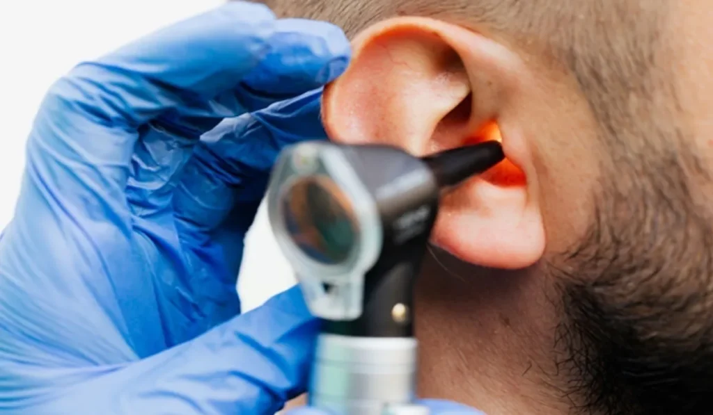 Treatment and Prevention of Ear Mold Infections